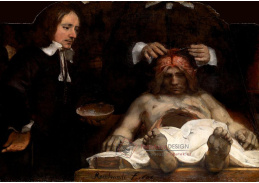 R4-176 Rembrandt - Lekce anatomie dr. Joana Deymana